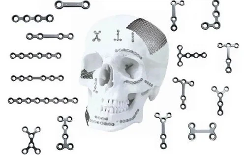 After the maxillofacial contour surgery, should I take out the titanium plate and titanium nail